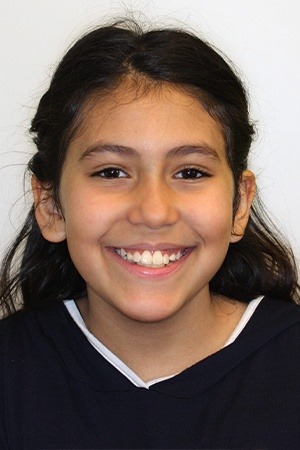 Young girl with gorgeous smile after orthodontics