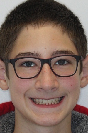 Young boy with flawless smile after braces treatment