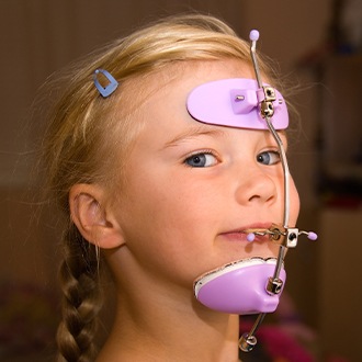 Girl with dentofacial orthopedics